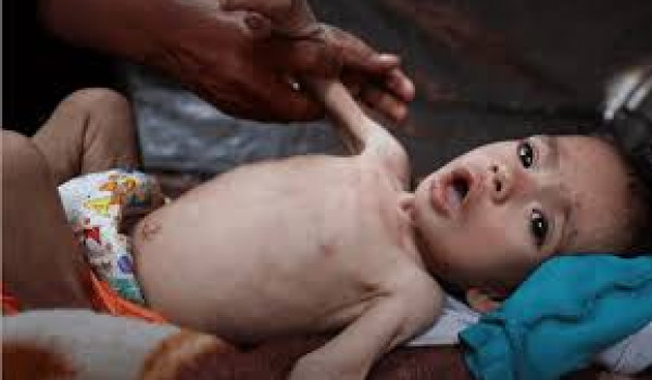 وزارة الصحة بغزة تحذر من تفشي الحمى الشو...