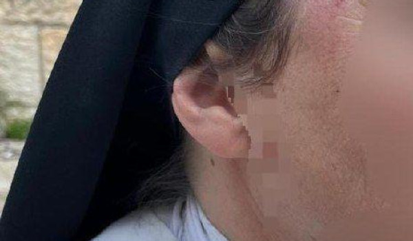 إصابة راهبة باعتداء مستعمر في القدس المح...