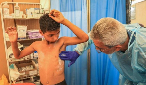 الأمم المتحدة تُحذر من تفشٍ واسع لـ 
