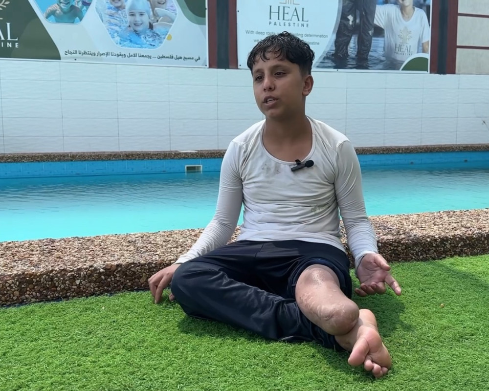 Amputee children in Gaza rebuild confidence through swimming program