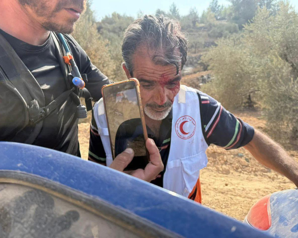 Four international activists injured, one in critical condition, in a settler attack at the Ein al-Duyuk gathering in J